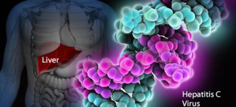 Karaciğer kanseri. Semptomlar, klinik, tedavi Karaciğer kanseri. Semptomlar, klinik, tedavi