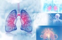 Ülkemizde En Sık Görülen Akciğer Kanseri